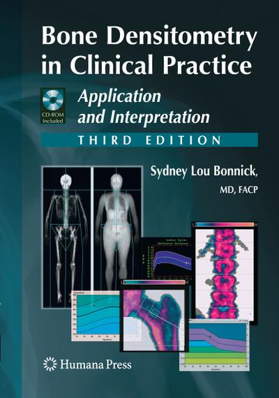 Bone Densitometry in Clinical Practice: Application and Interpretation (Current Clinical Practice)