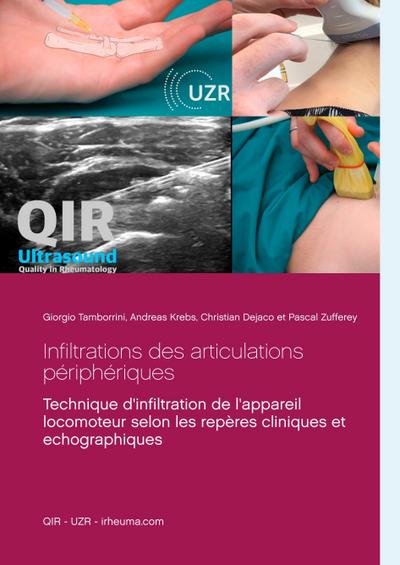 Infiltrations des articulations périphériques: Technique d`infiltration de l`appareil locomoteur selon les repères cliniques et echographiques