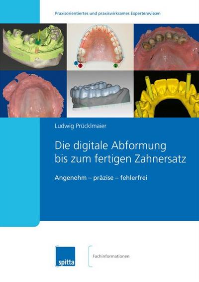 Die digitale Abformung bis zum fertigen Zahnersatz: Angenehm  präzise  fehlerfrei