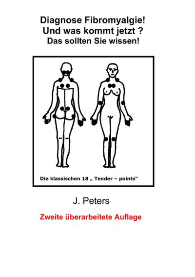 Diagnose Fibromyalgie! Und was kommt jetzt?: Das sollten sie Wissen!