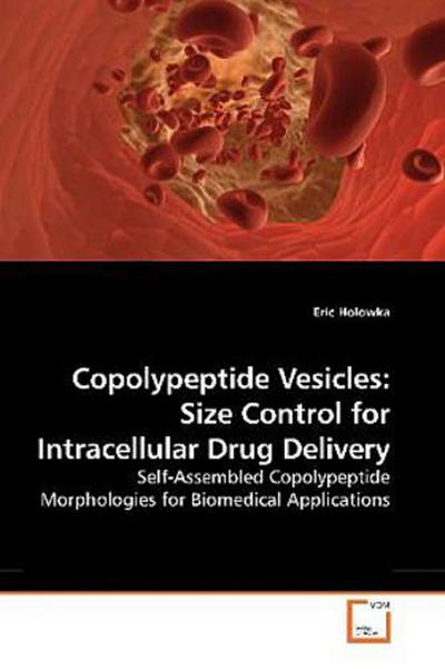 Copolypeptide Vesicles: Size Control for Intracellular Drug Delivery