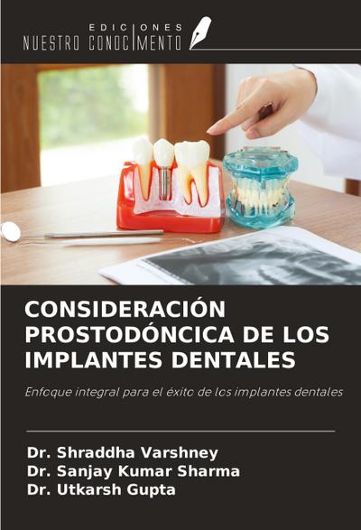 CONSIDERACIÓN PROSTODÓNCICA DE LOS IMPLANTES DENTALES