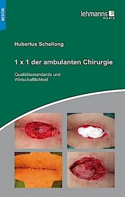 1 x 1 der ambulanten Chirurgie
