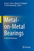 Metal-on-Metal Bearings