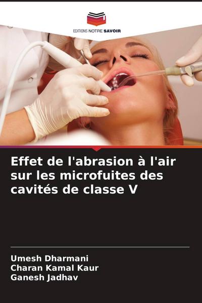 Effet de l’abrasion à l’air sur les microfuites des cavités de classe V