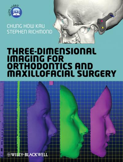 Three-Dimensional Imaging for Orthodontics and Maxillofacial Surgery