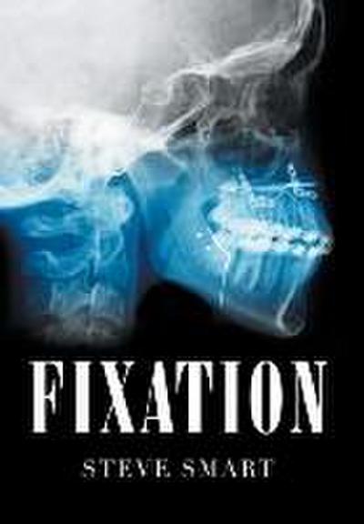 Fixation