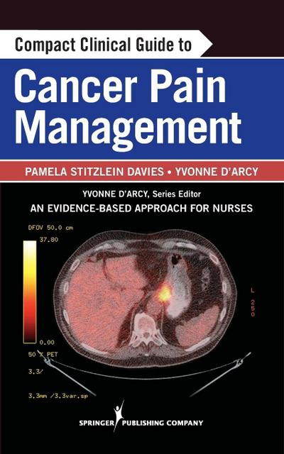 Compact Clinical Guide to Cancer Pain Management