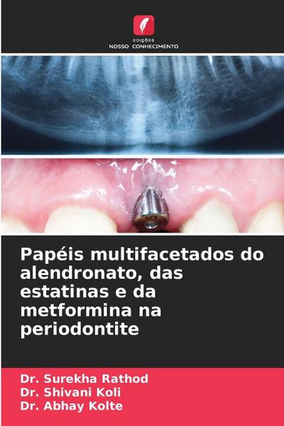 Papéis multifacetados do alendronato, das estatinas e da metformina na periodontite