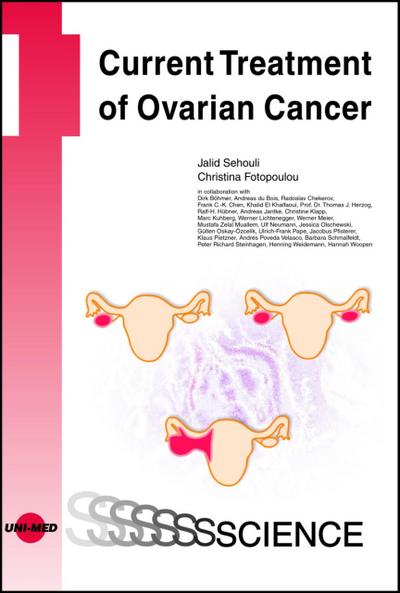 Current Treatment of Ovarian Cancer