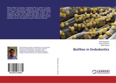 Biofilms in Endodontics