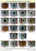 Konstitutionsorientierte Irisdiagnose