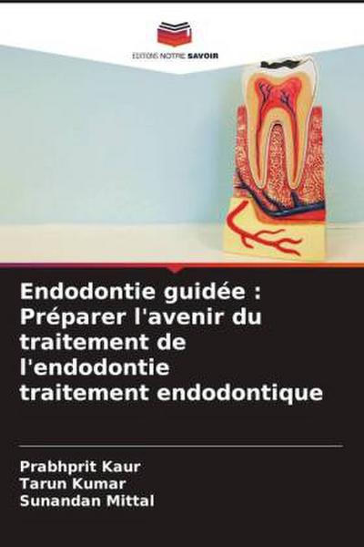 Endodontie guidée : Préparer l’avenir du traitement de l’endodontie traitement endodontique