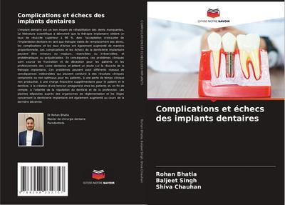 Complications et échecs des implants dentaires