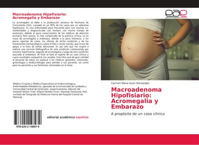 Macroadenoma Hipofisiario: Acromegalia y Embarazo