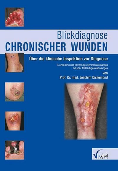 Dissemond, J: Blickdiagnose chronischer Wunden