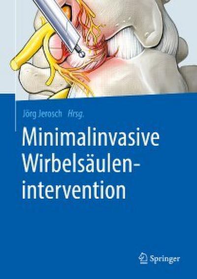 Minimalinvasive Wirbelsäulenintervention