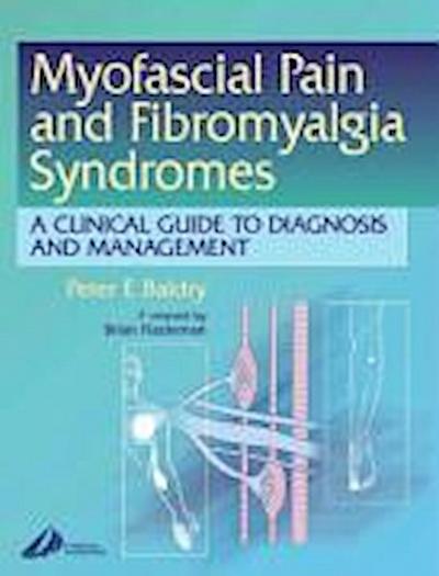 Myofascial Pain and Fibromyalgia Syndromes