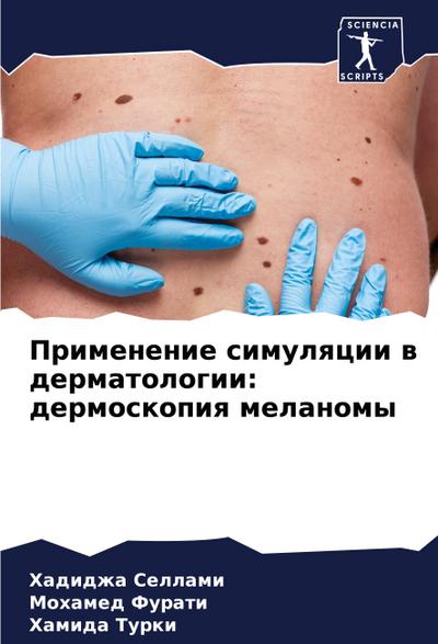 Primenenie simulqcii w dermatologii: dermoskopiq melanomy