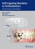Self-ligating Brackets in Orthodontics