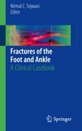 Fractures of the Foot and Ankle