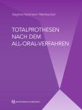 Totalprothesen nach dem All-Oral-Verfahren
