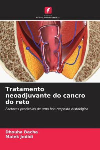 Tratamento neoadjuvante do cancro do reto