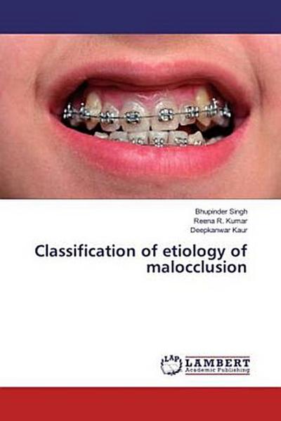 Classification of etiology of malocclusion