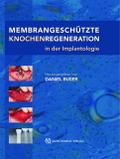 Membrangeschützte Knochenregeneration in der Implantologie von Daniel Buser | Ebook