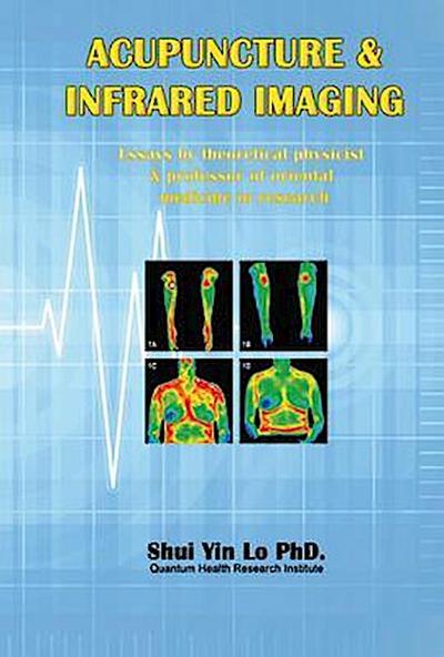 Acupuncture and Infrared Imaging