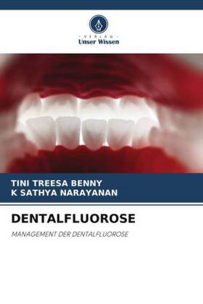 DENTALFLUOROSE