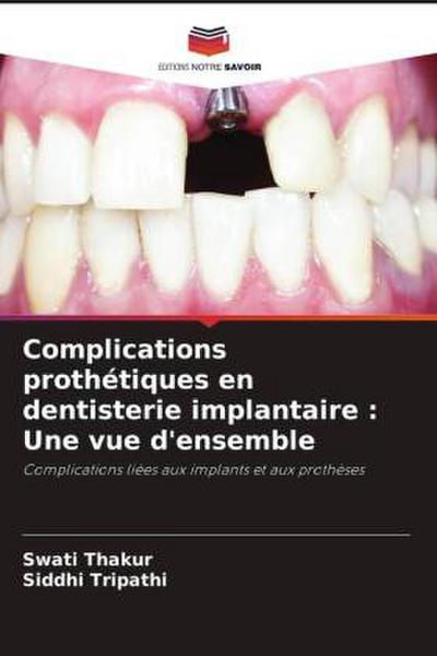 Complications prothétiques en dentisterie implantaire : Une vue d’ensemble
