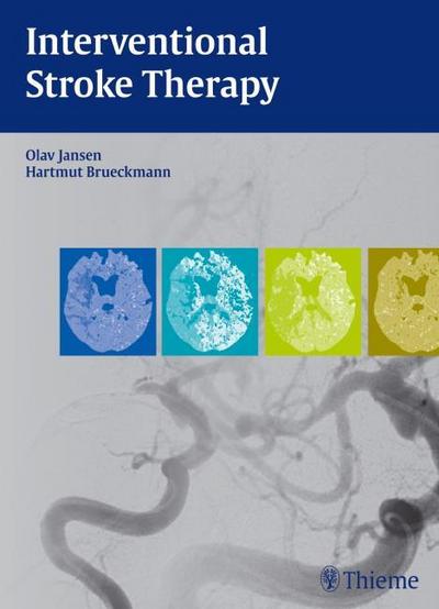 Stroke: Diagnostic Imaging and Endovascular Treatment