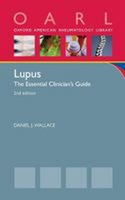 Lupus