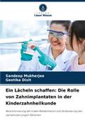 Ein Lächeln schaffen: Die Rolle von Zahnimplantate