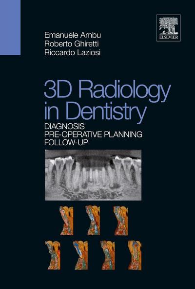 3D Radiology in Dentistry - Diagnosis Pre-Operative Planning Follow-Up