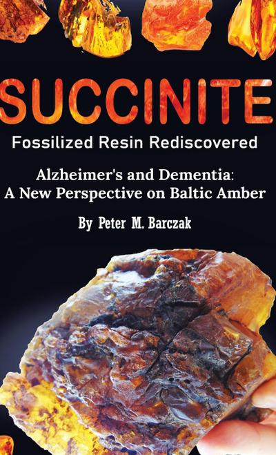 Succinite Fossilized Resin Rediscovered Alzheimer’s and Dementia
