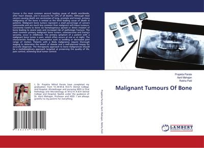 Malignant Tumours Of Bone