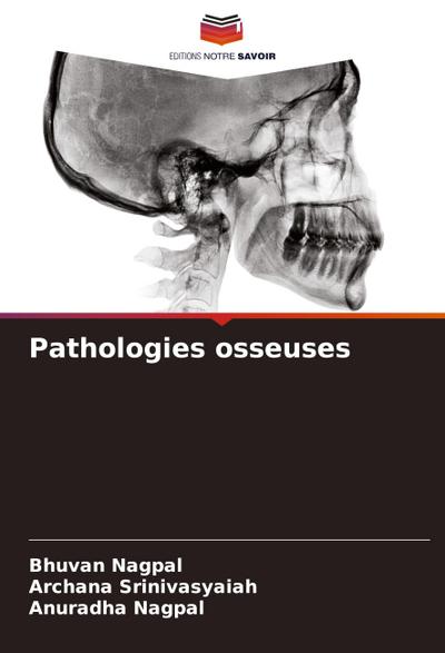 Pathologies osseuses