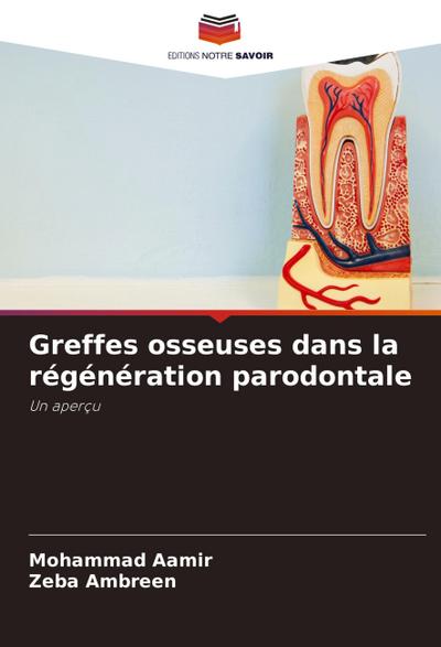 Greffes osseuses dans la régénération parodontale