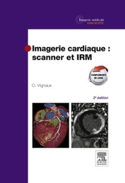 Imagerie cardiaque : scanner et IRM