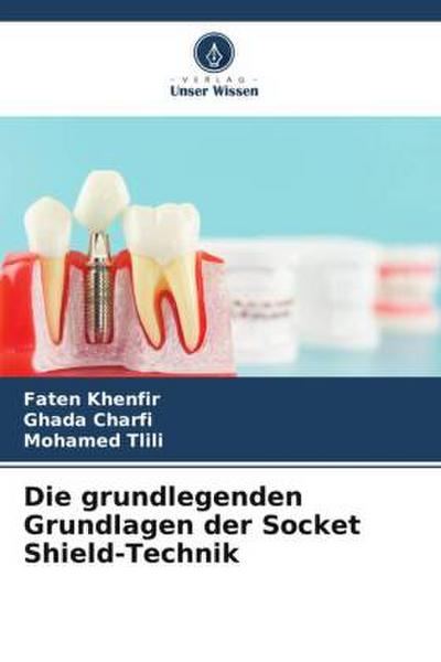 Die grundlegenden Grundlagen der Socket Shield-Technik