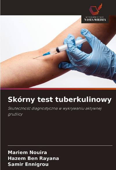 Skórny test tuberkulinowy