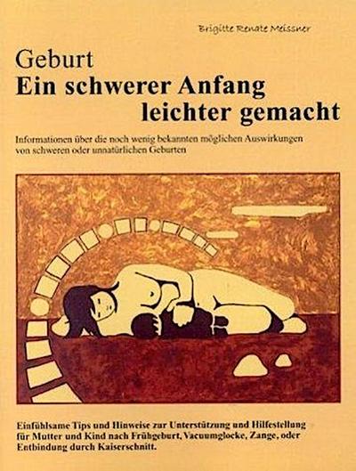 Geburt. Ein schwerer Anfang leichter gemacht