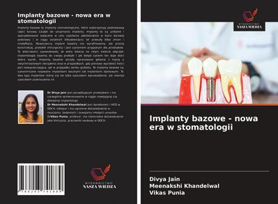 Implanty bazowe - nowa era w stomatologii