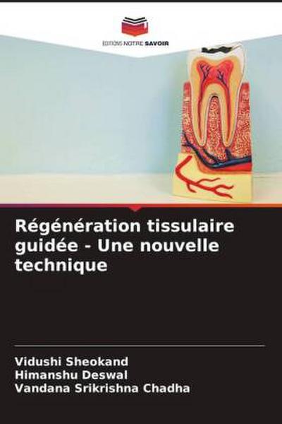 Régénération tissulaire guidée - Une nouvelle technique