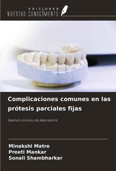 Complicaciones comunes en las prótesis parciales fijas