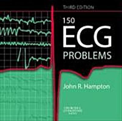 Hampton, J: 150 ECG Problems