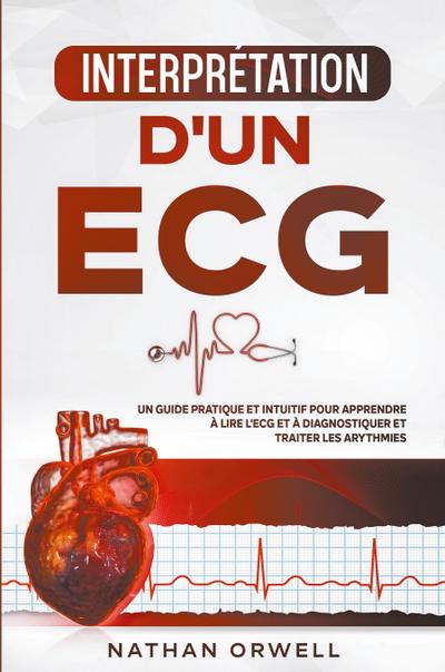Interprétation d’un ECG