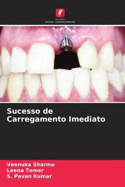 Sucesso de Carregamento Imediato